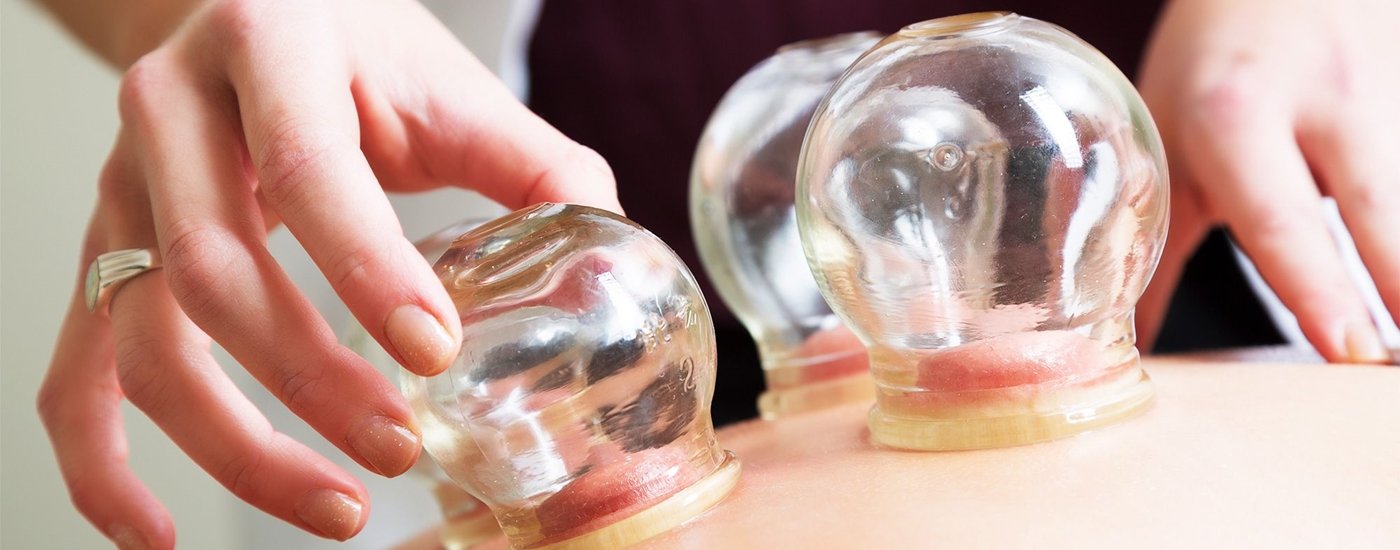 Cupping Massage Therapy Edmonton | AH Massage & Acupuncture