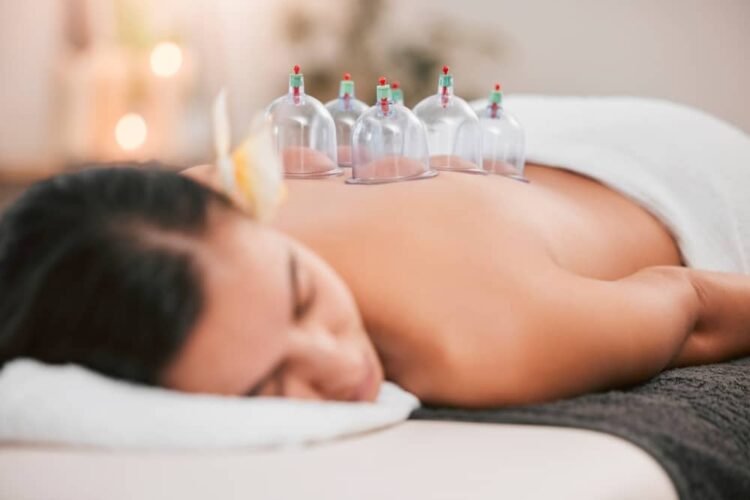 cupping massage Edmonton