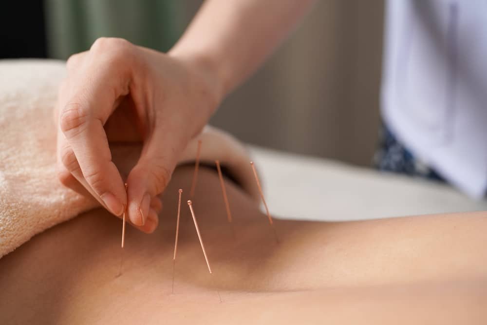 acupuncture for lower back pain Edmonton
