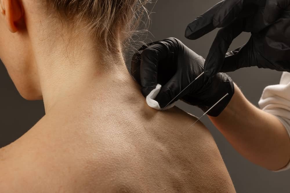 Acupuncture treatment for chronic neck pain and discomfort